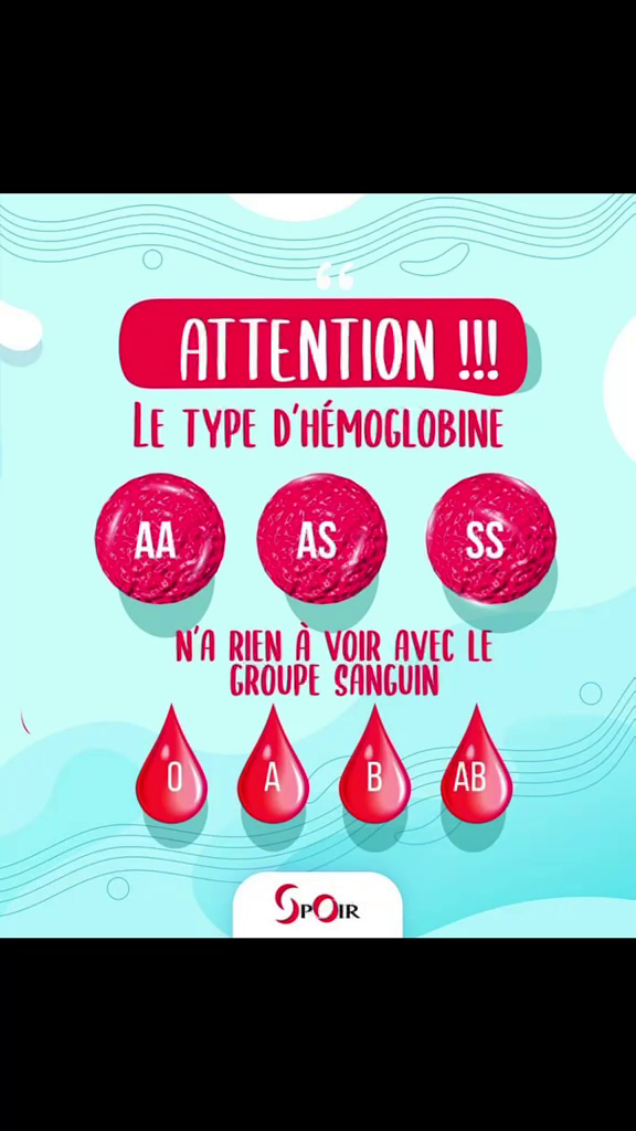 vlcsnap-2026-06-16-08h48m12s232 Drépanocytose en RDC : Le cri du cœur d’une survivante pour briser la chaîne de la « maladie du sang ».